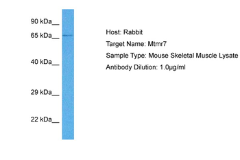MTMR7 Rabbit Polyclonal Antibody