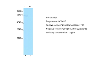 MTMR7 Rabbit Polyclonal Antibody