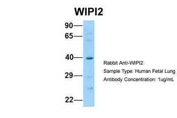 WIPI2 Rabbit Polyclonal Antibody