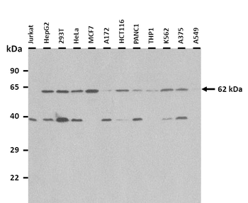 YTHDF2 Rabbit Polyclonal Antibody