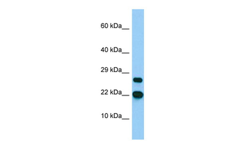 BTF3L4 Rabbit Polyclonal Antibody
