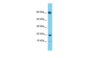 CNIH2 Rabbit Polyclonal Antibody