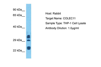 COLEC11 Rabbit Polyclonal Antibody
