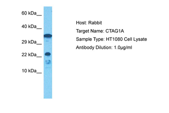 CTAG1A Rabbit Polyclonal Antibody