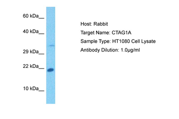 CTAG1A Rabbit Polyclonal Antibody
