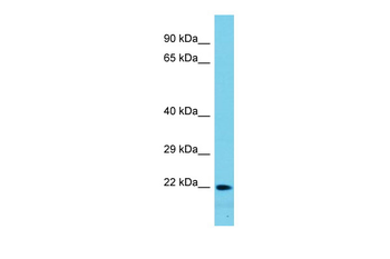 CTAG1A Rabbit Polyclonal Antibody