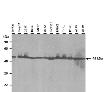 CXorf36 Rabbit Polyclonal Antibody