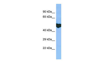 EXD2 Rabbit Polyclonal Antibody