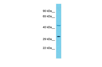 HAGHL Rabbit Polyclonal Antibody