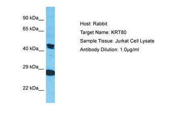 KRT80 Rabbit Polyclonal Antibody