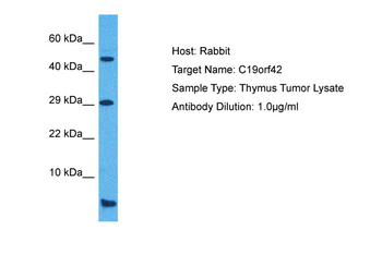 SMIM7 Rabbit Polyclonal Antibody