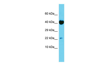 TRAPPC6A Rabbit Polyclonal Antibody