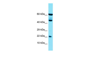 PLA2G12B Rabbit Polyclonal Antibody