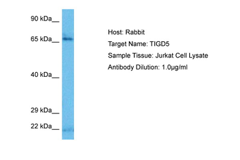 TIGD5 Rabbit Polyclonal Antibody