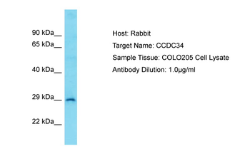 CCDC34 Rabbit Polyclonal Antibody