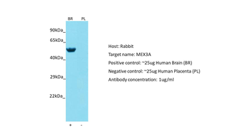 MEX3A Rabbit Polyclonal Antibody