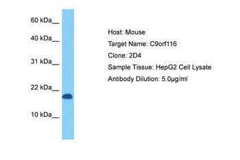 C9orf116 Rabbit Polyclonal Antibody
