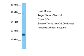 C9orf116 Rabbit Polyclonal Antibody