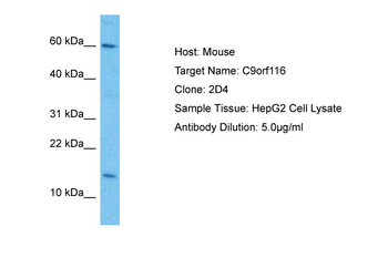 C9orf116 Rabbit Polyclonal Antibody