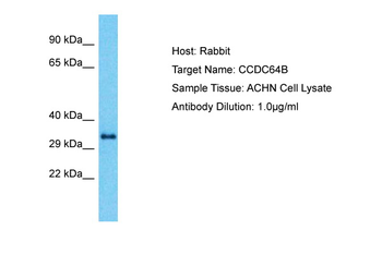 BICDL2 Rabbit Polyclonal Antibody