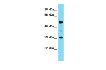 OR6Q1 Rabbit Polyclonal Antibody