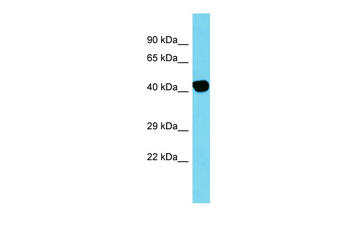 ACTBL2 Rabbit Polyclonal Antibody