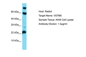VSTM5 Rabbit Polyclonal Antibody