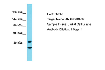 ANKRD20A8P Rabbit Polyclonal Antibody