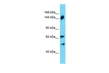 ANKRD18B Rabbit Polyclonal Antibody