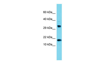 CPSF4L Rabbit Polyclonal Antibody
