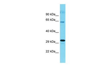 CWF19L1 Rabbit Polyclonal Antibody