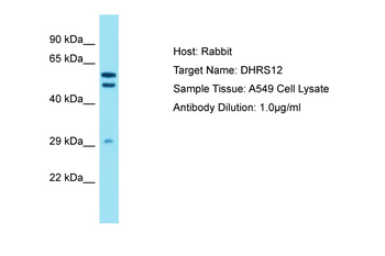 DHRS12 Rabbit Polyclonal Antibody
