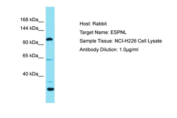 ESPNL Rabbit Polyclonal Antibody