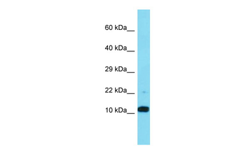 FAM25A Rabbit Polyclonal Antibody