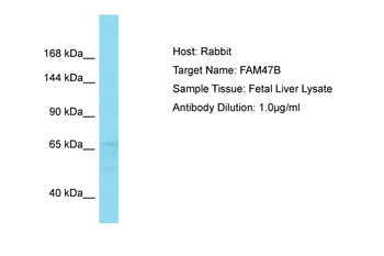 FAM47B Rabbit Polyclonal Antibody