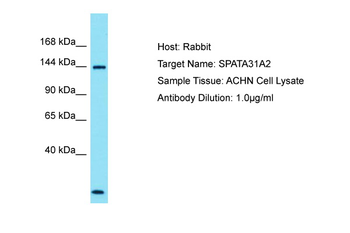 SPATA31A2 Rabbit Polyclonal Antibody