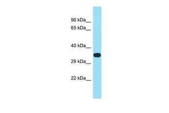 FAM102B Rabbit Polyclonal Antibody
