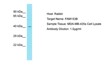 FAM153B Rabbit Polyclonal Antibody