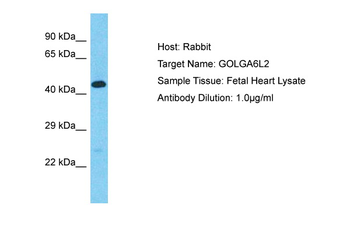 GOLGA6L2 Rabbit Polyclonal Antibody