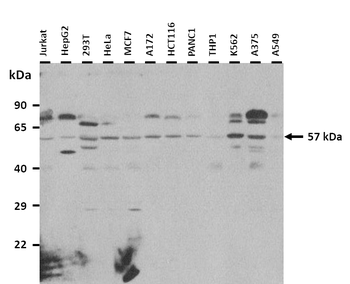 GPR176 Rabbit Polyclonal Antibody