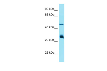 IFIT1 Rabbit Polyclonal Antibody