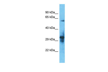 IGLON5 Rabbit Polyclonal Antibody
