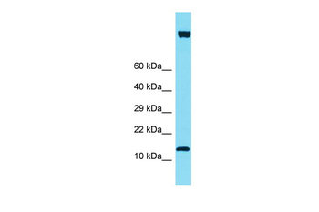 IQCF6 Rabbit Polyclonal Antibody