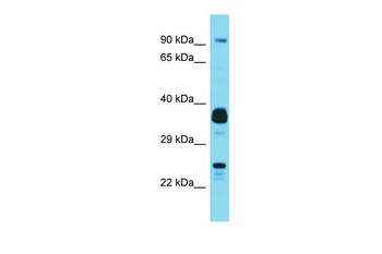 JOSD1 Rabbit Polyclonal Antibody