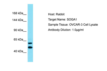 SOGA1 Rabbit Polyclonal Antibody