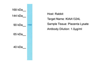KIAA1324L Rabbit Polyclonal Antibody