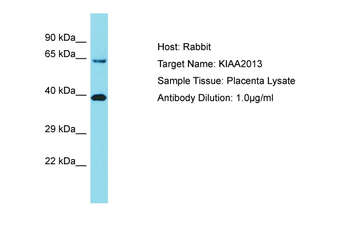 KIAA2013 Rabbit Polyclonal Antibody