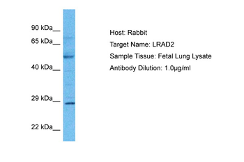 LDLRAD2 Rabbit Polyclonal Antibody