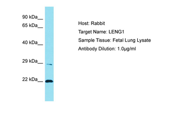 LENG1 Rabbit Polyclonal Antibody