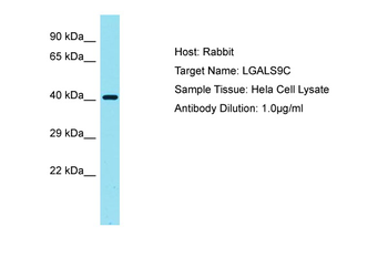 LGALS9C Rabbit Polyclonal Antibody